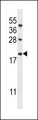 IFI6 / G1P3 Antibody - IFI6 Antibody western blot of MDA-MB453,CEM cell line lysates (35 ug/lane). The IFI6 antibody detected the IFI6 protein (arrow).