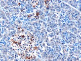 IFIH1 / MDA5 Antibody - Antibody (10 ug/ml) staining of paraffin embedded Human Pancreas. Microwaved antigen retrieval with Tris/EDTA buffer pH9, HRP-staining.