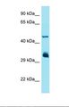 IFIT1 / ISG56 Antibody - Western blot of Human HepG2. IFIT1 antibody dilution 1.0 ug/ml.  This image was taken for the unconjugated form of this product. Other forms have not been tested.