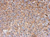 IFIT3 Antibody - IHC of paraffin-embedded HeLa xenograft using IFIT3 antibody at 1:500 dilution.