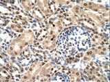 IFIT3 Antibody - IFIT3 antibody IFIT3(interferon-induced protein with tetratricopeptide repeats 3) Antibody was used in IHC to stain formalin-fixed, paraffin-embedded human kidney.  This image was taken for the unconjugated form of this product. Other forms have not been tested.