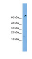 IFITM5 Antibody - IFITM5 antibody Western blot of HeLa lysate. This image was taken for the unconjugated form of this product. Other forms have not been tested.