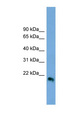 IFN Beta / Interferon Beta Antibody - IFNB1 / Interferon Beta antibody Western blot of HeLa lysate. This image was taken for the unconjugated form of this product. Other forms have not been tested.
