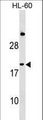 IFNA1 / Interferon Alpha 1 Antibody - IFNA1 Antibody western blot of HL-60 cell line lysates (35 ug/lane). The IFNA1 antibody detected the IFNA1 protein (arrow).