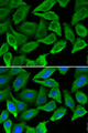 IFNA1 / Interferon Alpha 1 Antibody - Immunofluorescence analysis of A549 cells using IFNA1 antibody. Blue: DAPI for nuclear staining.
