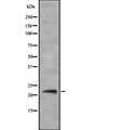 IFNA14 / Interferon Alpha 14 Antibody - Western blot analysis IFN14 using HeLa whole cells lysates