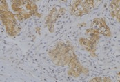 IFNA4 / Interferon Alpha 4 Antibody - 1:100 staining human uterus tissue by IHC-P. The sample was formaldehyde fixed and a heat mediated antigen retrieval step in citrate buffer was performed. The sample was then blocked and incubated with the antibody for 1.5 hours at 22°C. An HRP conjugated goat anti-rabbit antibody was used as the secondary.