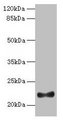 IFNAG Antibody - Western blot All lanes: IFNAG antibody at 2µg/ml + HL60 whole cell lysate Secondary Goat polyclonal to rabbit IgG at 1/10000 dilution Predicted band size: 22 kDa Observed band size: 22 kDa