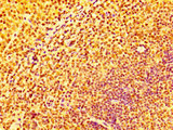 IFNGR2 Antibody - Immunohistochemistry image at a dilution of 1:100 and staining in paraffin-embedded human tonsil tissue performed on a Leica BondTM system. After dewaxing and hydration, antigen retrieval was mediated by high pressure in a citrate buffer (pH 6.0) . Section was blocked with 10% normal goat serum 30min at RT. Then primary antibody (1% BSA) was incubated at 4 °C overnight. The primary is detected by a biotinylated secondary antibody and visualized using an HRP conjugated SP system.