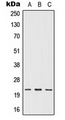 IFNW1 Antibody - Western blot analysis of IFN omega expression in HEK293T (A); NIH3T3 (B); H9C2 (C) whole cell lysates.