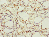 IFT20 Antibody - Immunohistochemistry of paraffin-embedded human thyroid tissue at dilution of 1:100