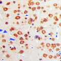 IGF1R / IGF1 Receptor Antibody - Immunohistochemical analysis of IGF1 Receptor staining in human brain formalin fixed paraffin embedded tissue section. The section was pre-treated using heat mediated antigen retrieval with sodium citrate buffer (pH 6.0). The section was then incubated with the antibody at room temperature and detected using an HRP conjugated compact polymer system. DAB was used as the chromogen. The section was then counterstained with hematoxylin and mounted with DPX.