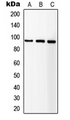 IGF1R / IGF1 Receptor Antibody - Western blot analysis of IGF1 Receptor expression in HEK293T (A); SP2/0 (B); NIH3T3 (C) whole cell lysates.
