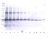 IGFBP3 Antibody - Biotinylated Anti-Human IGF-BP3 Western Blot Unreduced