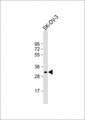 IGFBP5 Antibody - Anti-IGFBP5 Antibody (Center) at 1:2000 dilution + SK-OV-3 whole cell lysate Lysates/proteins at 20 ug per lane. Secondary Goat Anti-Rabbit IgG, (H+L), Peroxidase conjugated at 1:10000 dilution. Predicted band size: 31 kDa. Blocking/Dilution buffer: 5% NFDM/TBST.