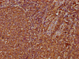 IGHA2 Antibody - Immunohistochemistry Dilution at 1:300 and staining in paraffin-embedded human tonsil tissue performed on a Leica BondTM system. After dewaxing and hydration, antigen retrieval was mediated by high pressure in a citrate buffer (pH 6.0). Section was blocked with 10% normal Goat serum 30min at RT. Then primary antibody (1% BSA) was incubated at 4°C overnight. The primary is detected by a biotinylated Secondary antibody and visualized using an HRP conjugated SP system.