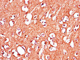 IGHMBP2 Antibody - Immunohistochemistry of paraffin-embedded human brain tissue using IGHMBP2 Antibody at dilution of 1:100