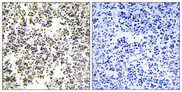 IGLL1 / CD179b Antibody - Immunohistochemistry analysis of paraffin-embedded human lymph node, using IGLL1 Antibody. The picture on the right is blocked with the synthesized peptide.