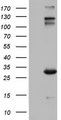 IGSF11 / VSIG3 Antibody - HEK293T cells were transfected with the pCMV6-ENTRY control (Left lane) or pCMV6-ENTRY IGSF11 (Right lane) cDNA for 48 hrs and lysed. Equivalent amounts of cell lysates (5 ug per lane) were separated by SDS-PAGE and immunoblotted with anti-IGSF11.