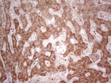 IGSF11 / VSIG3 Antibody - IHC of paraffin-embedded Human liver tissue using anti-IGSF11 mouse monoclonal antibody. (Heat-induced epitope retrieval by 1 mM EDTA in 10mM Tris, pH8.5, 120°C for 3min).