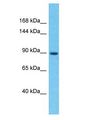 IGSF22 Antibody - IGSF22 antibody Western Blot of PANC1. Antibody dilution: 1 ug/ml.  This image was taken for the unconjugated form of this product. Other forms have not been tested.