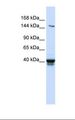 IGSF9 Antibody - Fetal lung lysate. Antibody concentration: 1.0 ug/ml. Gel concentration: 6-18%.  This image was taken for the unconjugated form of this product. Other forms have not been tested.