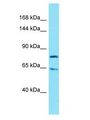 IGSF9B Antibody - IGSF9B antibody Western Blot of Jurkat. Antibody dilution: 1 ug/ml.  This image was taken for the unconjugated form of this product. Other forms have not been tested.