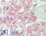 ABCB10 Antibody - Human Placenta: Formalin-Fixed, Paraffin-Embedded (FFPE)