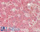 ABCB2 / TAP1 Antibody - Human Liver: Formalin-Fixed, Paraffin-Embedded (FFPE)
