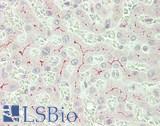 ABCC2 / MRP2 Antibody - Human Liver: Formalin-Fixed, Paraffin-Embedded (FFPE)