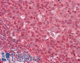 ABCG8 Antibody - Human Tonsil: Formalin-Fixed, Paraffin-Embedded (FFPE)