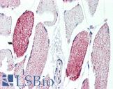 ACO2 / Aconitase 2 Antibody - Anti-ACO2 antibody IHC of human skeletal muscle. Immunohistochemistry of formalin-fixed, paraffin-embedded tissue after heat-induced antigen retrieval. Antibody concentration 10 ug/ml.