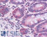 ACSL4 / FACL4 Antibody - Anti-ACSL4 antibody IHC of human small intestine. Immunohistochemistry of formalin-fixed, paraffin-embedded tissue after heat-induced antigen retrieval. Antibody concentration 3.75 ug/ml.