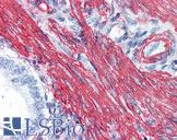 ACTA2 / Smooth Muscle Actin Antibody - Anti-ACTA2 antibody IHC of human uterus. Immunohistochemistry of formalin-fixed, paraffin-embedded tissue after heat-induced antigen retrieval. Antibody concentration 5 ug/ml.