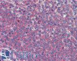 ADAM8 Antibody - Human Spleen: Formalin-Fixed, Paraffin-Embedded (FFPE)