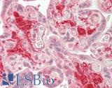 ADAM9 Antibody - Human Placenta: Formalin-Fixed, Paraffin-Embedded (FFPE)