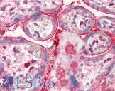 ADAP2 / CENTA2 Antibody - Anti-ADAP2 / CENTA2 antibody IHC of human placenta. Immunohistochemistry of formalin-fixed, paraffin-embedded tissue after heat-induced antigen retrieval. Antibody concentration 5 ug/ml.