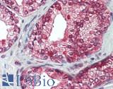 ADRA1A Antibody - Human Prostate: Formalin-Fixed, Paraffin-Embedded (FFPE)