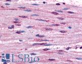 ADRA1B / Adrenoceptor alpha 1B Antibody - Anti-ADRA1B antibody IHC of human smooth muscle cells. Immunohistochemistry of formalin-fixed, paraffin-embedded tissue after heat-induced antigen retrieval.