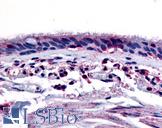 AHR Antibody - Anti-Aryl Hydrocarbon Receptor antibody IHC of human respiratory epithelium and bronchial smooth muscle. Immunohistochemistry of formalin-fixed, paraffin-embedded tissue after heat-induced antigen retrieval.