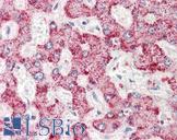 AIG1 Antibody - Anti-AIG1 antibody IHC staining of human liver. Immunohistochemistry of formalin-fixed, paraffin-embedded tissue after heat-induced antigen retrieval.