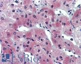 AIPL1 Antibody - Anti-AIPL1 antibody IHC of human adrenal. Immunohistochemistry of formalin-fixed, paraffin-embedded tissue after heat-induced antigen retrieval. Antibody concentration 5 ug/ml.