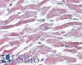 AKT3 Antibody - Anti-AKT3 antibody IHC of human heart. Immunohistochemistry of formalin-fixed, paraffin-embedded tissue after heat-induced antigen retrieval. Antibody concentration 5 ug/ml.