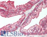 ALDH1A3 Antibody - Human Prostate: Formalin-Fixed, Paraffin-Embedded (FFPE)