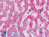 ALDH5A1 Antibody - Human Liver: Formalin-Fixed, Paraffin-Embedded (FFPE)