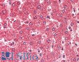 ALDH5A1 Antibody - Anti-ALDH5A1 antibody IHC staining of human liver. Immunohistochemistry of formalin-fixed, paraffin-embedded tissue after heat-induced antigen retrieval. Antibody concentration 5 ug/ml.
