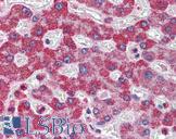 ALDH5A1 Antibody - Anti-ALDH5A1 antibody IHC of human liver. Immunohistochemistry of formalin-fixed, paraffin-embedded tissue after heat-induced antigen retrieval. Antibody concentration 5 ug/ml.