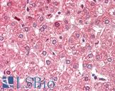 ALDH6A1 Antibody - Anti-ALDH6A1 antibody IHC staining of human liver. Immunohistochemistry of formalin-fixed, paraffin-embedded tissue after heat-induced antigen retrieval. Antibody concentration 5 ug/ml.