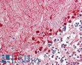 ALDH9A1 Antibody - Anti-ALDH9A1 antibody IHC staining of human brain, cerebellum. Immunohistochemistry of formalin-fixed, paraffin-embedded tissue after heat-induced antigen retrieval.