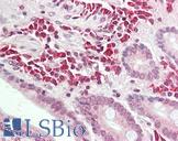 ALK3 / BMPR1A Antibody - Anti-ALK3 / BMPR1A antibody IHC staining of human small intestine. Immunohistochemistry of formalin-fixed, paraffin-embedded tissue after heat-induced antigen retrieval. Antibody dilution 1:100.